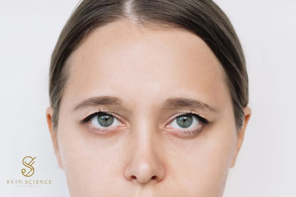 A woman with hooded upper eyelids