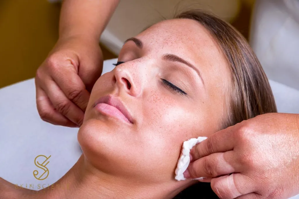 Chemical peel being applied to a young woman's face