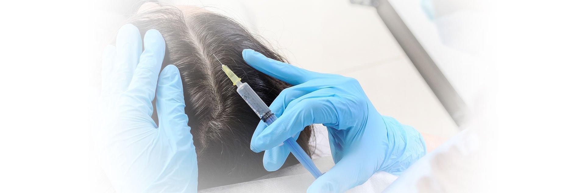PRP-Hair-Treatment With Skin Science Clinic London
