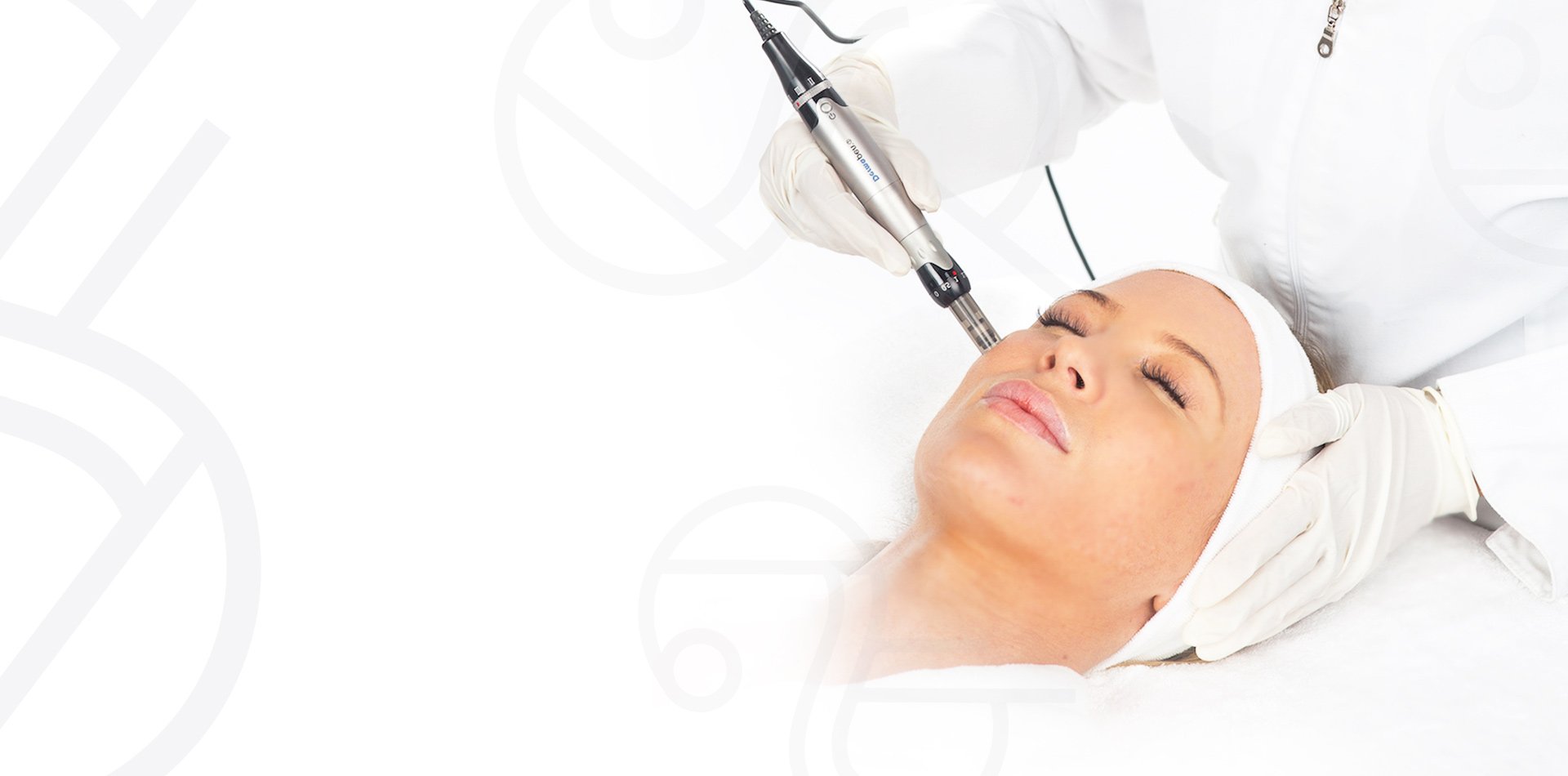 Dermapen treatment