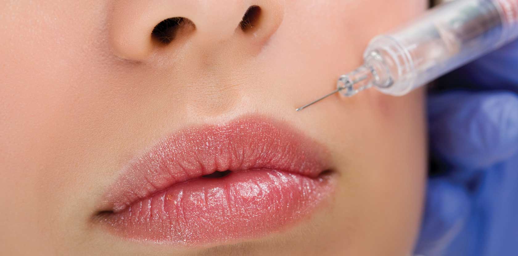 Close-up of a fine needle injection beside the lips