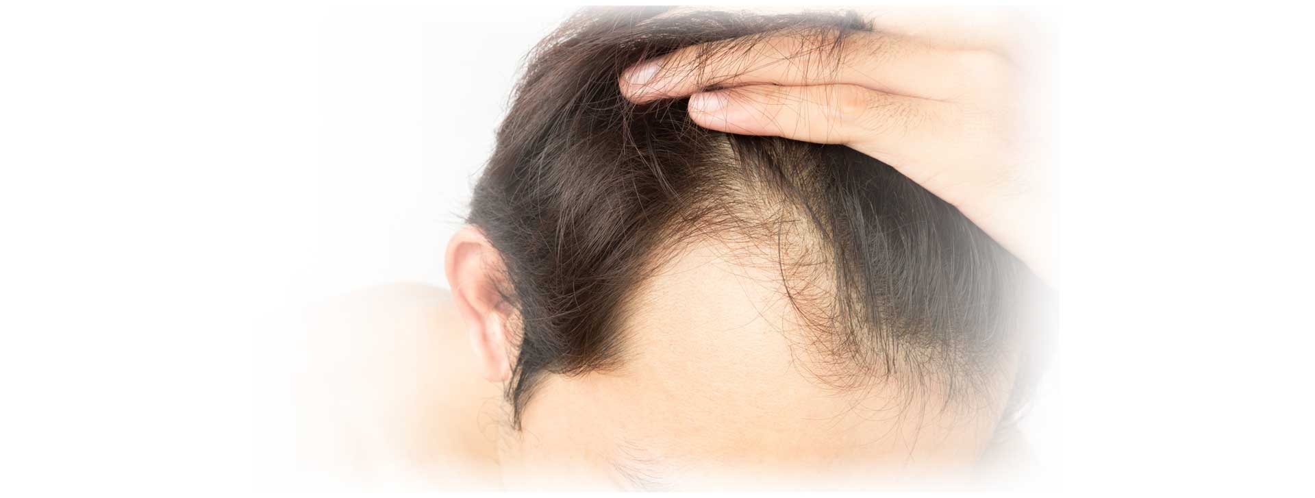 Hair transplant at Skin Science Clinic, London