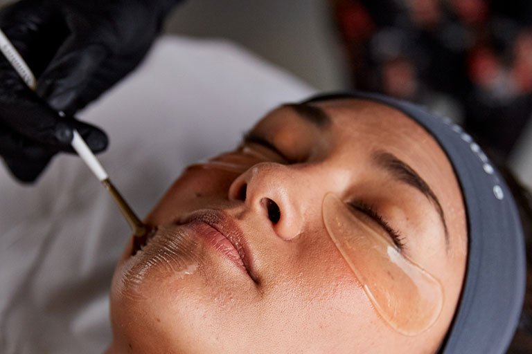 AlumierMD chemical peels at Skin Science Clinic