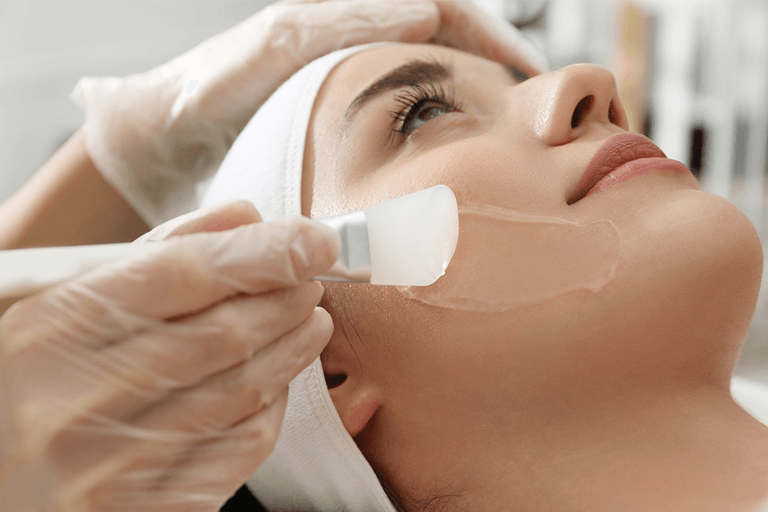 Woman having a chemical peel