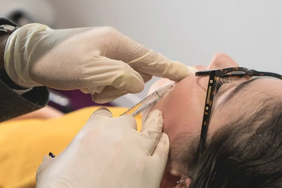 Cheek filler restoring mid-face volume
