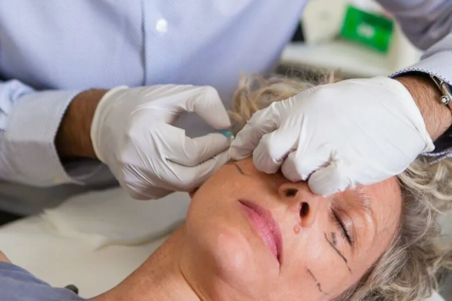 Tear trough filler treating under-eye hollowing