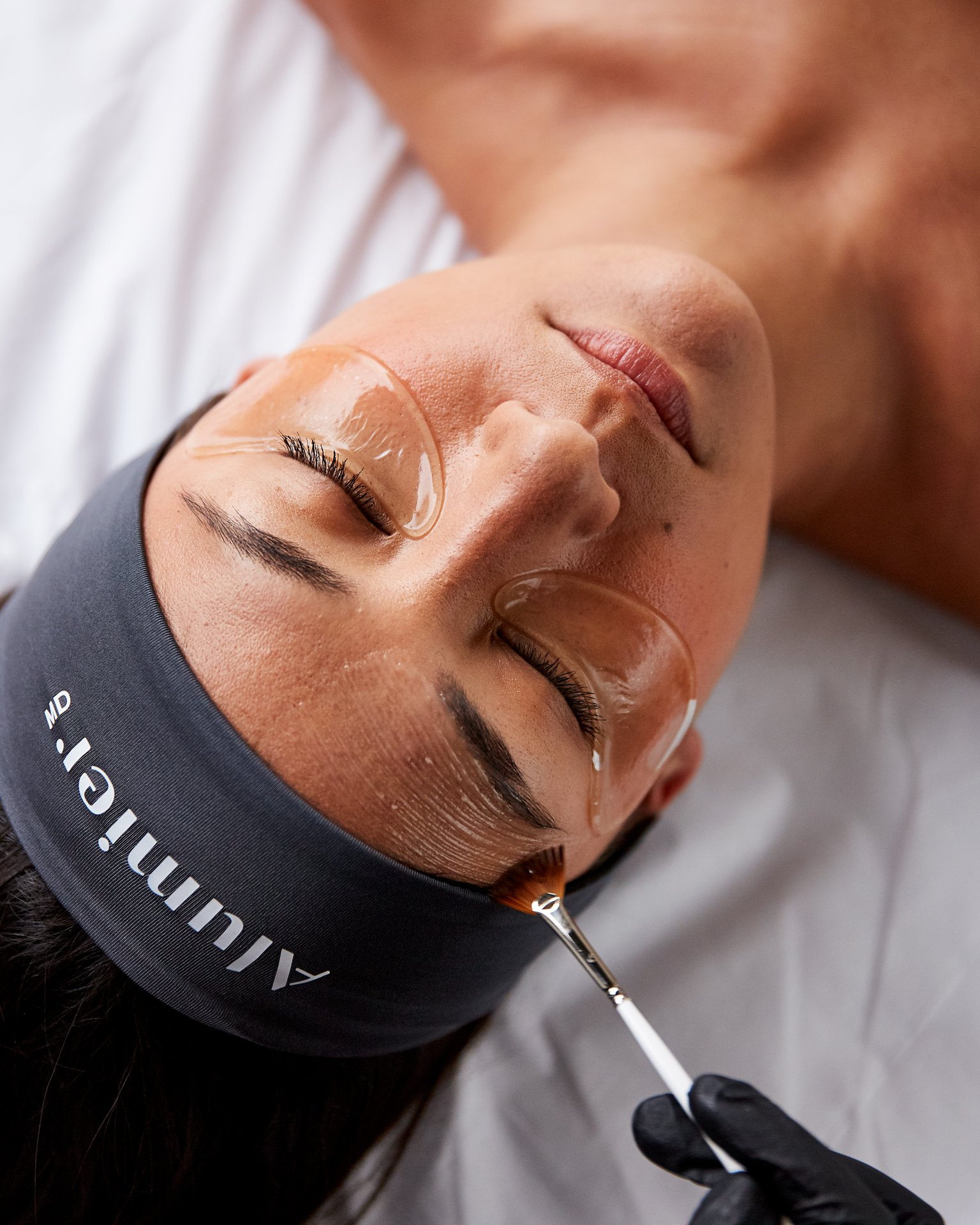 AlumierMD chemical peels at Skin Science Clinic in London