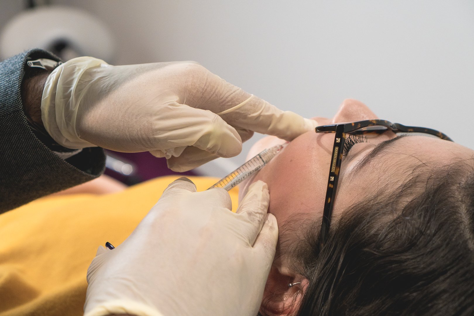 Cheek Filler Procedure