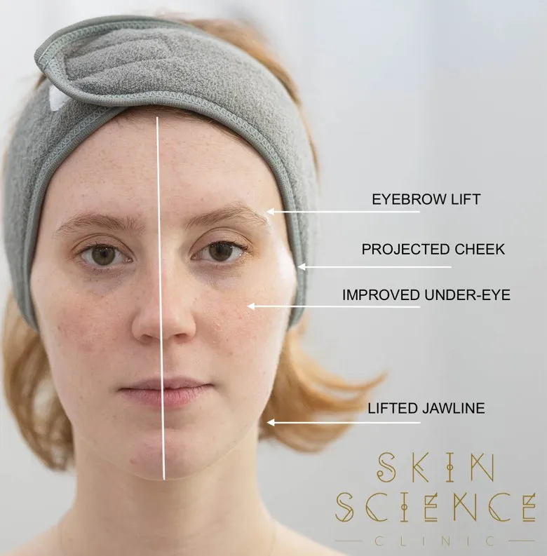 Cryotherapy before and after, with detail