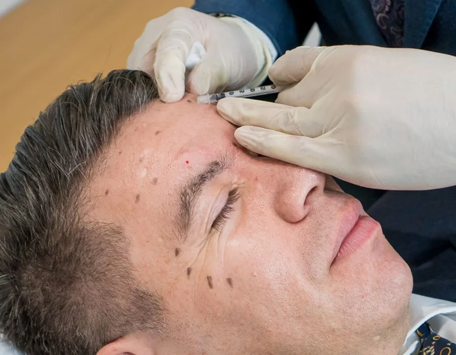 FOREHEAD RESHAPING at Skin Science Clinic in London