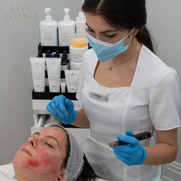 Dermapen at Skin Science Clinic London