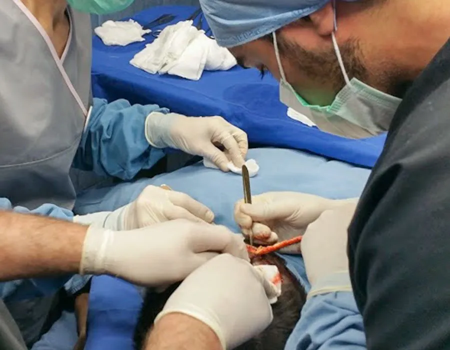 Hair transplant operation with Dr Adil Sarwar at Skin Science Clinic in London
