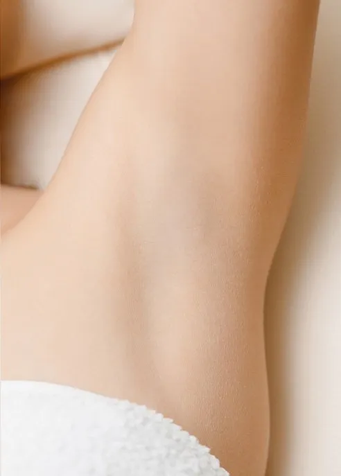 Laser hair removal on a woman’s underarm, after treatment