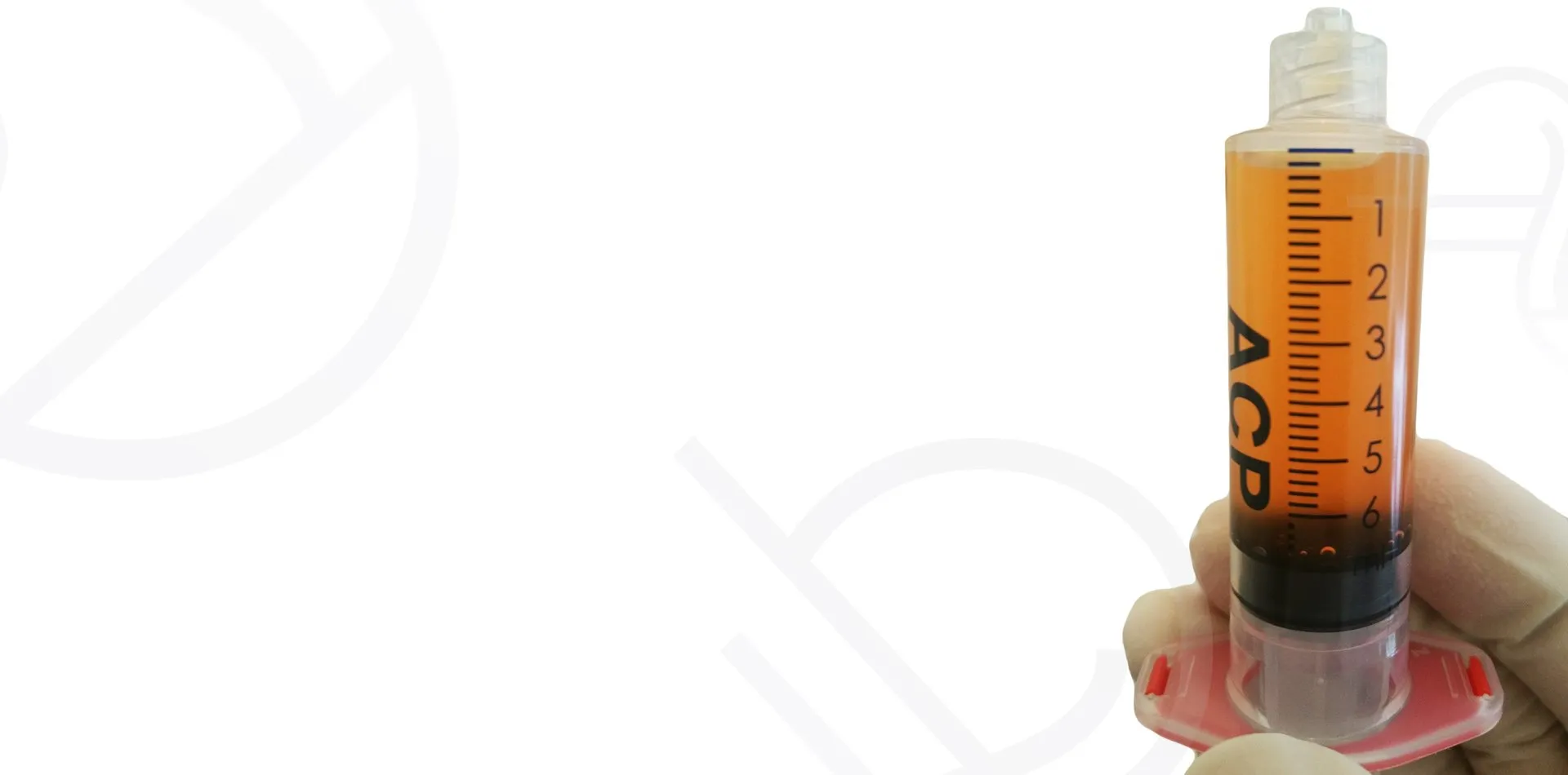 PRP preparation kit at Skin Science Clinic, London