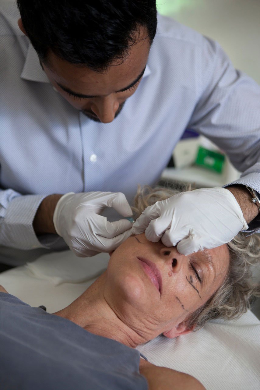 Dr Sarwar performing tear trough filler treatment in London
